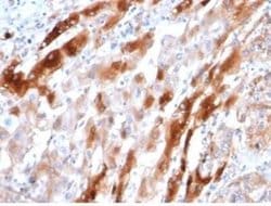 Glutamine Synthetase Mouse anti-Human, Clone: GLUL/6604, Novus Biologicals